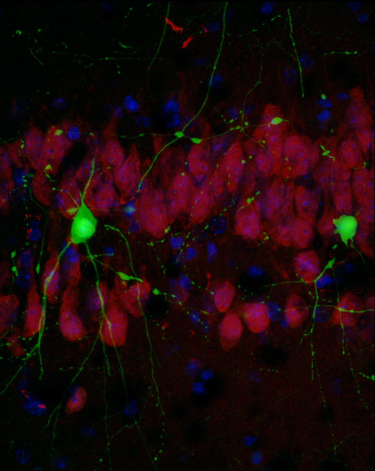 Detección de la proteína Crtc1 en neuronas del hipocampo de ratón. La proteína destaca en color verde Fuente: UAB