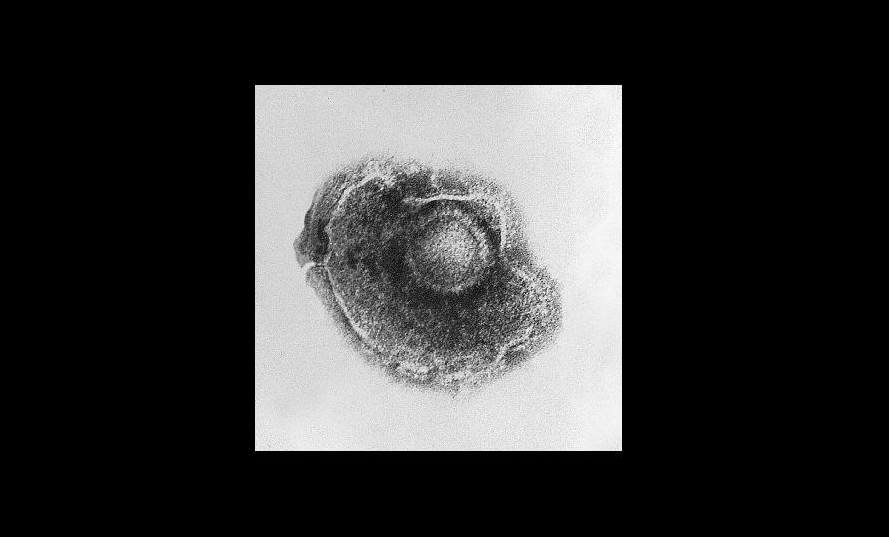 Virus de la varicela Autor/a: CDC/Dr. Erskine Palmer/B.G. Partin Fuente: TimVickers / Wikipedia