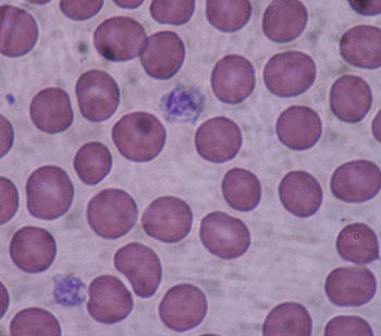 Dos plaquetas (púrpura) bajo el microscopio de luz (40x) de un extensión de sangre periférica rodeada por eritrocitos Autor/a: Bobjgalindo  Fuente: Wikipedia