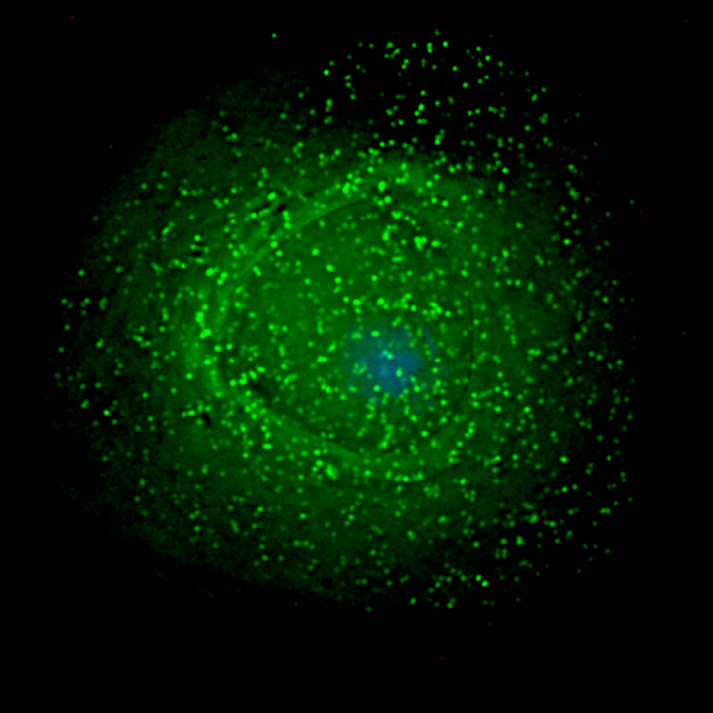 VIH en macrófago (célula del sistema inmunitario en los tejidos) Autor/a: Reconfirming the Traditional Model of HIV Particle Assembly. Gross L, PLoS Biology Fuente: Ayacop / Wikimedia Commons