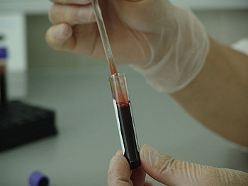 análisis de sangre