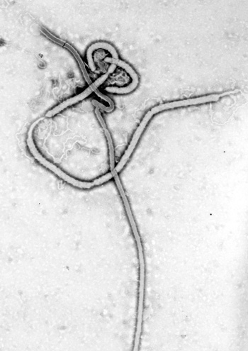 Virus Ébola Autor/a: CDC/ Dr. Frederick A. Murphy / Centers for Disease Control and Prevention's Public Health Image Library (PHIL) Fuente: Wikipedia / Splintercellguy
