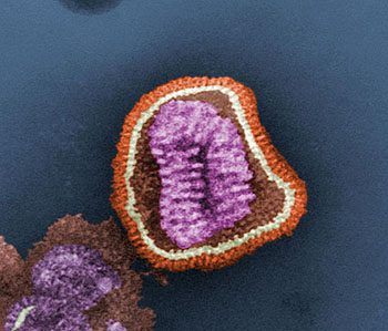 Partícula viral o ‘virión’ del virus de la gripe Autor/a: Cynthia Goldsmith Content Providers(s): CDC/ Dr. Erskine. L. Palmer; Dr. M. L. Martin - Centers for Disease Control and Prevention's Public Health Image Library (PHIL), #10073  Fuente: Wikipedia / Optigan13