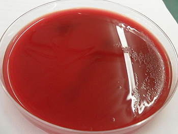 Cultivo  de Clostridium difficile Autor/a de la imagen: Copacopac Fuente: Wikimedia Commons
