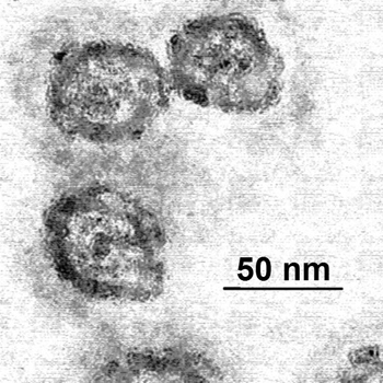 Representación del virus de la hepatitis C Autor/a de la imagen: PhD Dre at en.wikipedia Fuente: Wikipedia / LobStoR
