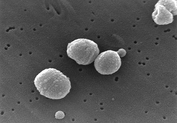 Neumococo, 'Streptococcus pneumoniae' Autor/a de la imagen: CDC/Janice Carr Content Providers(s): CDC/Dr. Richard Facklam (cargado por Encephalon) Fuente: Wikipedia