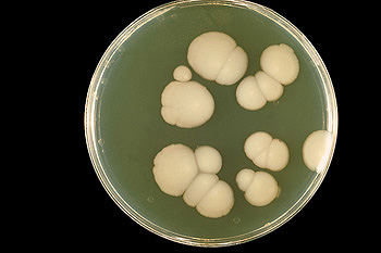 Cultivo de Candida albicans, en la mayoría de casos el agente causante de la candidiasis Autor/a de la imagen: CDC/Dr. William Kaplan Fuente: Wikipedia / Martin H.