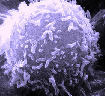 Linfocito (microscopio electrónico de barrido) Autor/a: Dominio público / Modificaciones de color de la imagen: DO11.10 Fuente: Dr. Triche National Cancer Institute / Wikipedia / DO11.10