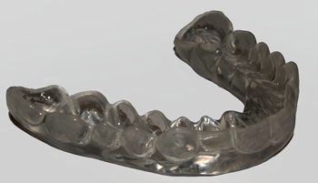 Una férula dental protectora puede ayudar a reducir el rechinamiento de los dientes Autor/a de la imagen: Erijon479 Fuente: Wikipedia