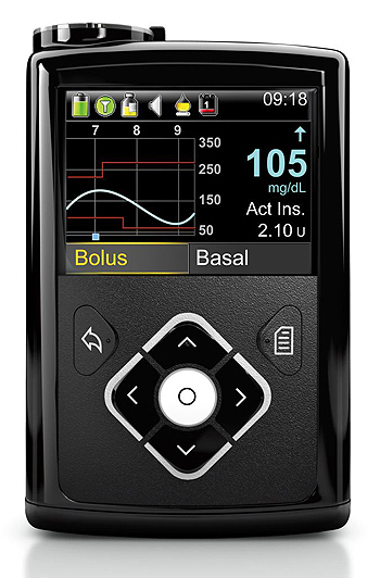 La bomba de insulina MiniMed 640G Fuente: Medtronic