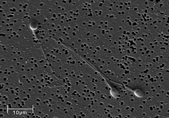 Micrografía por microscopio electrónico de barrido (SEM) de células de esperma humano (espermatozoides)  Autor/a de la imagen: No specific author (sin autor específico) Fuente: Wikimedia Commons / Forskerunv