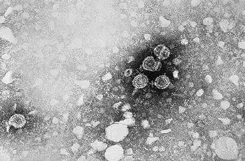 Micrografía que muestra viriones de hepatitis B (VHB) Autor/a de la imagen: CDC/Dr. Erskine Palmer (PHIL #270), 1981. Fuente: Wikipedia