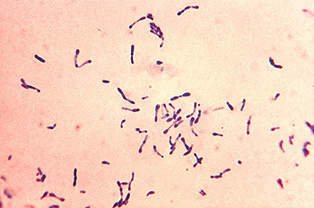 ‘Corynebacterium diphtheriae’, bacilo causante de la difteria Autor/a de la imagen: Credit:Content Providers(s): - This media comes from the Centers for Disease Control and Prevention's Public Health Image Library (PHIL), with identification number #7323 Fuente:  Wikimedia Commons