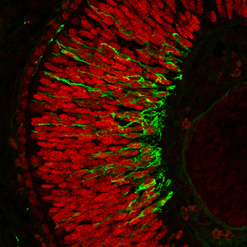 Expresión de Meis1 (en rojo) en la retina de un embrión silvestre y también teñida con un marcador de neuronas (en verde) Fuente: CIBER 