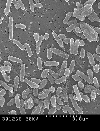 Fotografía de Micobacterium brumae al microscopio Fuente: UAB
