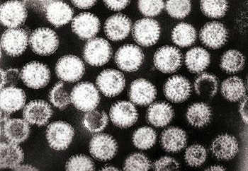 Rotavirus en las heces de un niño infectado Autor/a de la imagen: Dr Graham Beards Fuente: Wikipedia / Kakoui