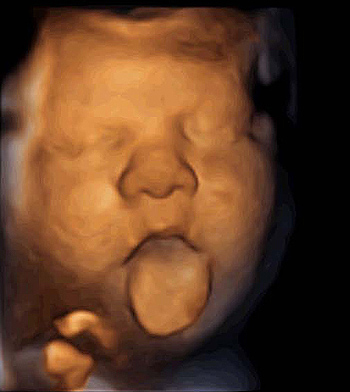 Imagen de un feto durante el estudio ‘Expresión facial fetal en respuesta a la emisión de música vía vaginal’ Fuente: Instituto Marqués /  Weber Shandwick
