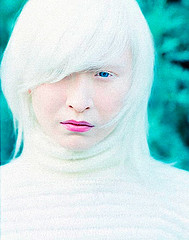 Persona albina Autor/a de la imagen: Amber Case Fuente: Flickr / Creative Commons