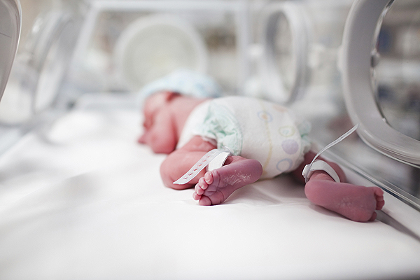 Un bebé prematuro Fuente de la imagen: HM Hospitales 