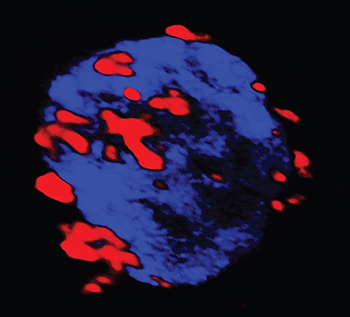 Célula autoreactiva (azul) que capta los nanofármacos (rojo) que se agrupan en la membrana Fuente: IDIBAPS / Hospital Clínic