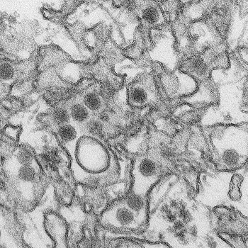 Micrografía electrónica del virus Zika Autor/a de la imagen: CDC/ Cynthia Goldsmith- http://phil.cdc.gov/phil/details.asp?pid=20487 Fuente: Wikipedia