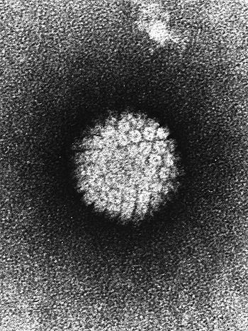 Virus del papiloma humano visto con microscopio electrónico de transmisión Autor/a de la imagen / Fuente:  Laboratory of Tumor Virus Biology - NIH-Visuals Online# AV-8610-3067 Difusión: Wikipedia