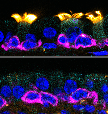 GEMC1 es necesario para generar células multiciliadas. Imágenes de las tráqueas de ratones. Los cilios (en amarillo) son notorios en los modelos con el gen (sup.), mientras que los modelos que no lo tienen, carecen de ellos (Berta Terré, IRB Barcelona) Fuente: IRB Barcelona