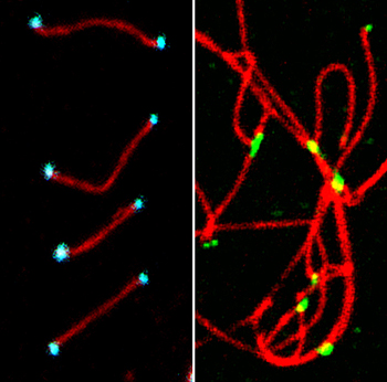 Sin RingoA, los telómeros (verde) -extremos de los cromosomas - se fusionan entre ellos lo que produce fallos en meiosis y muerte celular. Con la proteína en telómeros (azul), los cromosomas se mantienen separados. Autor/a y fuente: Petra Mikolcevic, IRB Barcelona
