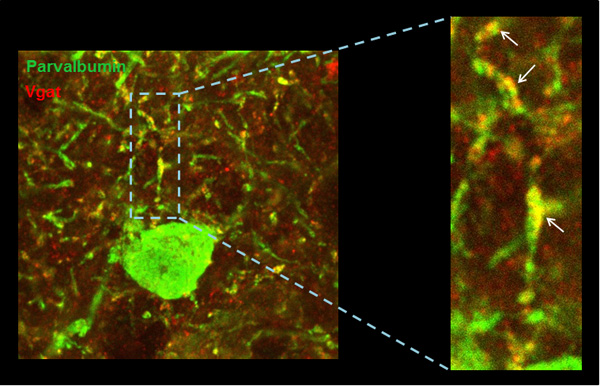 La actividad de la neurona inhibitoria (verde) es controlada por los contactos de tipo inhibitorio (rojo) que recibe. Este control se ha visto afectado en la corteza cerebral del modelo de ratón de síndrome de Down. Fuente: CRG / Institut d’Investigacions Biomèdiques August Pi i Sunyer (IDIBAPS)