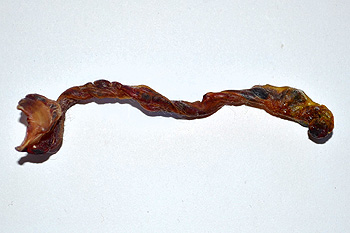Un cordón umbilical Autor/a de la imagen: Greg G  Fuente: Wikipedia