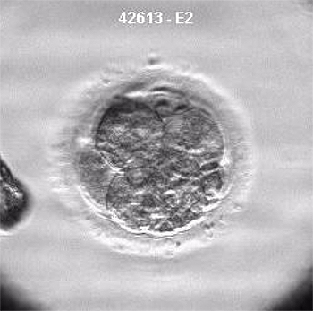 Un embrión Fuente: Clínica Tambre / COM SALUD