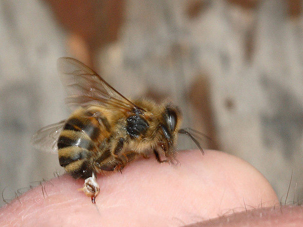 Picadura de una abeja. Este método sirve para aplicar el veneno de abeja, a modo de terapia, en el paciente  Autor/a de la imagen: Waugsberg Fuente: Wikimedia Commons
