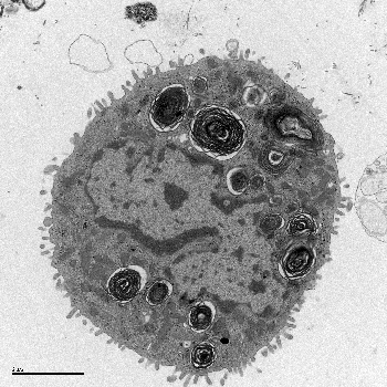 Célula alveolar tipo II vista al microscopio electrónico Fuente: IBB-CSIC/Hospital Clínic