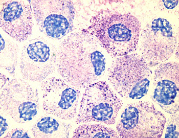 Imagen tomada con un microscopio óptico, en la que se observan mastocitos teñidos con azul de toluidina Autor/a de la imagen: Kauczuk  Fuente: Wikipedia