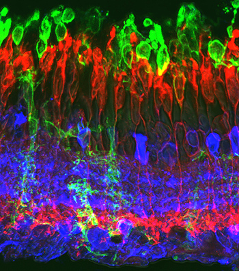 Imagen histológica de la retina de un animal rd10 al mes de edad, en la que se observa una alteración importante de la capa de los fotorreceptores de la retina Fuente: IBEC / IQAC / CSIC