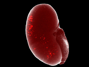 Células progenitoras renales de laboratorio (en rojo) después de ser trasplantadas a un riñón y que tienen la capacidad de integrarse  funcionalmente y  formar parte  del mismo Fuente: Hospital Clínic 