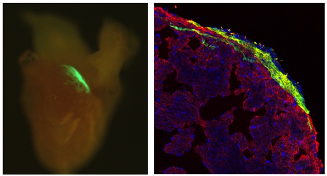 Corazón de pez cebra adulto: en verde la descendencia de las células marcadas (izquierda). Ampliación de la zona marcada, mostrando células cardíacas fotoactivadas en verde, entremezcladas con células sin marcar (derecha) Fuente: IBEC
