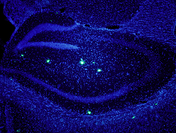La beta amiloide está fuertemente asociada a Alzheimer; queda por revelar su contribución. Muestra de cerebro de ratón que sobreexpresa beta amiloide. En azul, núcleos neuronales. En verde, algunas placas de beta amiloide (E.Verdaguer/S.Brox) Fuente: IRB Barcelona
