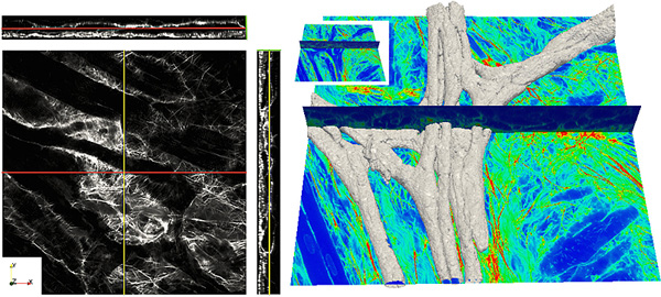 (izquierda), imagen de las fibras de Purkinje en microscopía confocal, (derecha) la reconstrucción en 3D Fuente: UPF