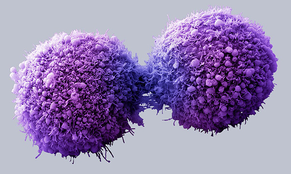 Células de páncreas cancerosas completando la división celular Getty Images/Visuals Unlimited Imagen difundida por: UPF