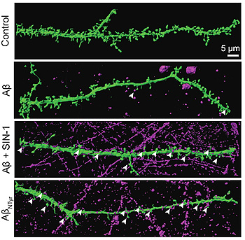 Figura cedida por los autores-Aumento de oligómeros Aβ nitrados y unidos a las sinapsis Fuente: UPF