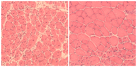 Músculo dañado en ratones envejecidos (izquierda) y músculo regenerado en ratones tratados con la técnica de reprogramación (derecha) Autor/a de la imagen: Salk Institute Fuente: Hospital Clínic
