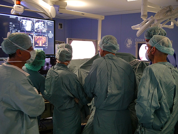 Equipo quirúrgico de la Clínica durante un momento de la intervención por laparoscopia de un donante vivo de hígado Fuente: Clínica Universidad de Navarra 