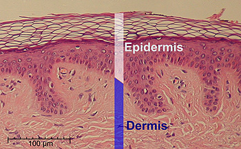 Epidermis en un corte histológico (delimitada por barra blanca vertical) Autor/a de la imagen: Normal_Epidermis_and_Dermis_with_Intradermal_Nevus_10x.JPG: Kilbad Cropped and labeled by Fama Clamosa (talk) and Mikael Häggström, respectively - Normal_Epidermis_and_Dermis_with_Intradermal_Nevus_10x.JPG (Public Domain) Scale at lower left was created from the an estimation of mean epidermal cell nuclei of 8.6 μm according to the following study: (2011). "Automated identification of epidermal keratinocytes in reflectance confocal microscopy". Journal of Biomedical Optics 16 (3): 030502. DOI:10.1117/1.3552639. ISSN 10833668 Fuente: Wikipedia 