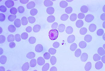 Plasmodium vivax Autor/a de la imagen: Content Providers(s): CDC/Dr. Mae Melvin Creation Date: 1973 Copyright Restrictions: None - This image is in the public domain and thus free of any copyright restrictions. As a matter of courtesy we request that the content provider be credited and notified in any public or private usage of this image. CDC http://phil.cdc.gov/phil_images/20021230/20/PHIL_2727_lores.jpg Fuente: Wikipedia 