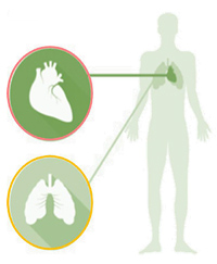 Hipertensión Arterial Pulmonar Fuente: Actelion / Clapers de Diego