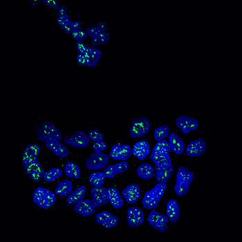Núcleos de células metastáticas de cáncer de mama con la proteína MSK1 en verde (Autor: Cristina Figueras-Puig, IRB Barcelona) Fuente: IRB Barcelona