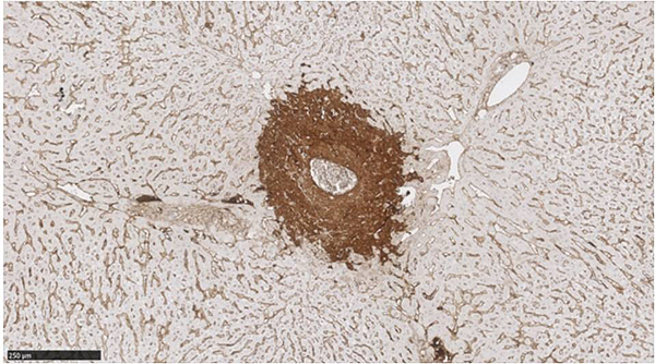 Muestra histológica de una lesión provocada mediante ablación por radiofrecuencia no térmica en el hígado de un conejo (foto: BERG-UPF) Fuente: UPF 