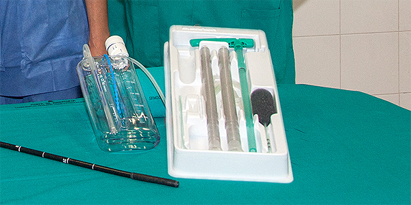 Detalle del bote de vacío (a la izq.) y de la endoesponja (el objeto negro de la derecha, muy parecido a un micrófono)