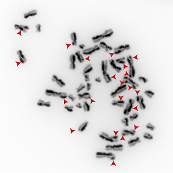 Cromosomas de células con mutaciones en el gen TOP3A que presentan numerosos intercambios SCE (Sister chromatid exchange) Fuente: UAB
